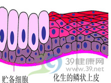 鳞状上皮细胞化生图片图片